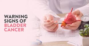 Sometimes, people with bladder cancer do not have any of these changes. Urology Ck Birla Hospital Page 3