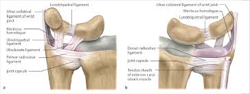 Image result for Triangular Fibrocartilage Complex Injury