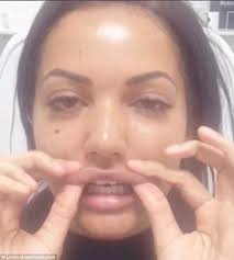 Loren Green showcases eye-popping result of £20K surgery