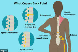 Your lower back is called the lumbar region, and therefore low back pain is often referred to as lumbago. Back Pain Causes Treatment And When To See A Doctor