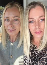 “The results speak for themselves.” But why do they call it Fresh Start?  Because skin doesn't just need more—it needs a reset. Fresh Start Essence  is designed to wake up tired,