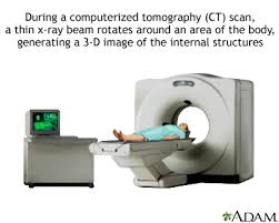 A ct scan is typically used for: Heart Ct Scan Medlineplus Medical Encyclopedia