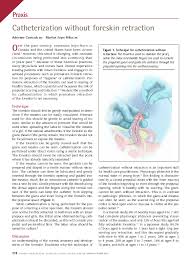 Use a prelubricated condom for a couple of months (yes, months). Pdf Catheterization Without Foreskin Retraction Marilyn Milos Academia Edu
