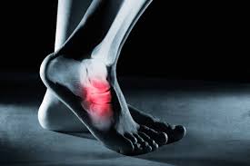 Image result for Foot Fracture