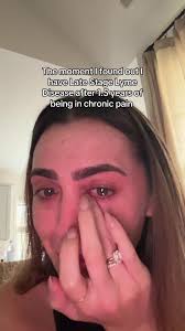 Understanding Chronic Illness and Lyme Disease Diagnosis