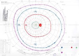 Eye test comment the hidden number. Visual Field Testing From One Medical Student To Another