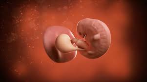 These all are the signs of spontaneous miscarriage. 6 Weeks Pregnant Pregnancy Sma Baby