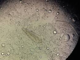 Image result for Demodex brevis