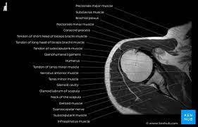 How much is a shoulder mri. Normal Shoulder Mri How To Read A Shoulder Mri Kenhub
