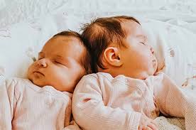 See more of twins on facebook. Conjoined Twins Patient Stories Uc Davis Children S Hospital