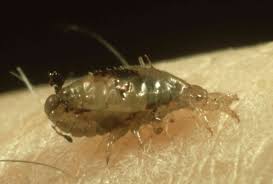 Do wet combing on days 1, 5, 9 and 13 to catch any newly hatched head lice. Pictures Of Head Lice On Hair