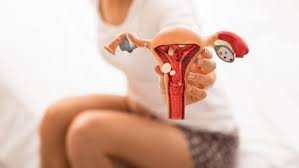 Penyebab darah beku saat haid). Kenali Gejala Hiperplasia Endometrium Penebalan Dinding Rahim Pada Wanita