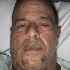 Fundraiser by Rebecca Wills-Fussell : To help with ongoing expenses for  Jerry J.