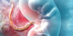 Hematoma Retrocorial En El Embarazo Que Es Causas Sintomas Y Como Eliminarlo