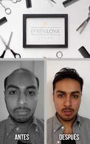 Ur skeudenn nevez zo bet ouzhpennet...