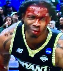 Bloody Injury in Sports Game