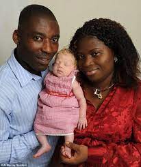 Healthy african boy with rare blue eyes. The Truth Behind Black Africans With Blue Eyes