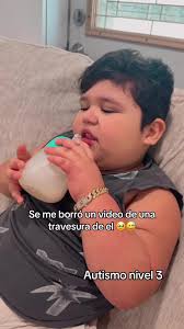 Mi Rey Bello: La Belleza de Carlos y su Autismo