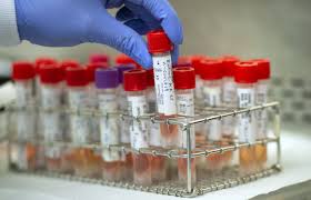 Los Angeles County Opens New Drive Up Testing Sites Increasing Covid 19 Testing Capacity For Residents Throughout La County