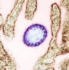 Epidemiology as the virus is thought to be spread from pigs to. 2018 Nipah Virus Outbreak In Kerala Wikipedia