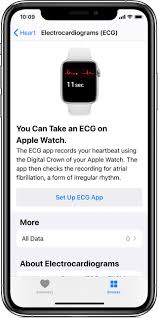 taking an ecg with the ecg app on apple watch series 4 or