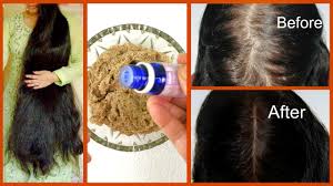 Best us products, parenting, dog training, pest control blog. Howto How To Get Rid Of Dandruff And Hairfall At Home