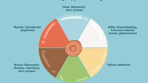 Breast pain can often be remedied with simple solutions, but sometimes it's an indication of something more serious. Nipple Discharge Symptoms Causes Diagnosis And Treatment