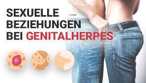 Genitalherpes Und Sexuelle Beziehungen Sind Sie Kompatibel