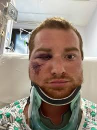 Motorcycle Accident Highlights Importance of Wearing Safety Gear