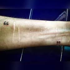 The eschar forms within a few days (median 5 days) after the bite, and may take several weeks to heal completely. Eschar Photos Facebook