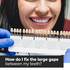 𝐖𝐎𝐎 𝐃𝐄𝐍𝐓𝐀𝐋 (@w_dentistry) • Instagram photos and videos