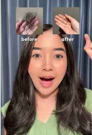 masih ganyangka rambut rontok yang kemarin bikin stress pelan-pelan  membaik. semenjak rutin pake rangkaian kelaya jujurr rambut aku jadi lebih  kuat dan ga gampang rontok lagii #YourDailyExpert ...