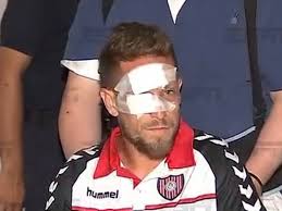 Habló Brandán, el jugador de Chacarita agredido, tras los dichos de  Gorosito: "Me duele en el alma"