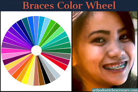 Based on a circle showing the colors of the spectrum originally fashioned by sir isaac newton in 1666, the colour wheel he created serves many purposes today. Braces Color Wheel And Ideas Orthodontic Braces Care