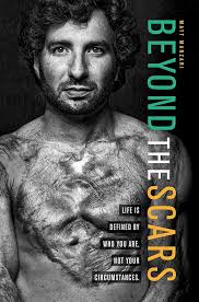 Amazon.com: Beyond the Scars: Life is Defined by Who You Are, Not Your  Circumstances: 9781951492281: Manzari, Matt: Books