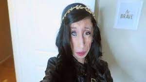 Sejak kecil, lizzie velasquez kerap mendapat ejekan dari orang di sekitarnya. Inilah Kisah Perempuan Terjelek Di Dunia