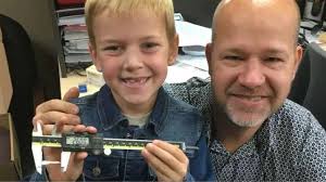 40 strangest world records ever set you won t believe exist photogallery. 9 Year Old Canada Boy Holds Guinness World Record For Longest Milk Tooth Extracted Trending News India Tv