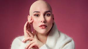 At 13, the stress of my parents' toxic divorce caused my hair to fall out.  It never grew back. This is what all divorcing couples need to know: LAURA  MATHIAS