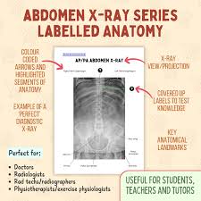 Image result for Abdominal XRay