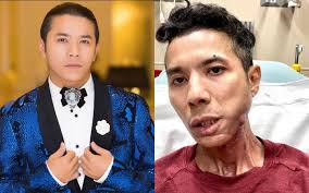 Kasim Hoàng Vũ đang gặp chuyện đáng lo, đồng nghiệp kêu gọi hỗ trợ