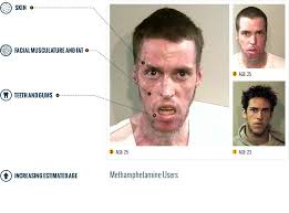 As of 2015, around 6 percent of the american population (aged 12 and older) had tried it at least once, the national institute on drug abuse (nida) reports. Before And After Drugs Meth