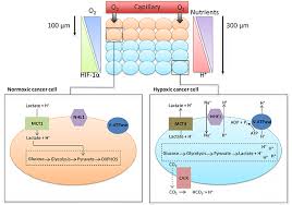 Check spelling or type a new query. The Impact Of Tumour Ph On Cancer Progression Strategies For Clinical Intervention