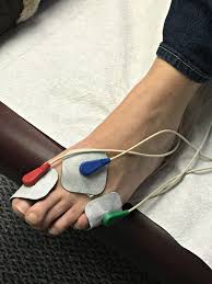 Alternative and Natural Approaches to Small Fiber Neuropathy Treatment