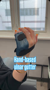 Image result for Ulnar Gutter Splint
