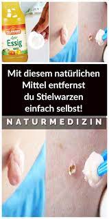Mit Diesem Naturlichen Mittel Entfernst Du Stielwarzen Einfach Selbst Stielwarzen Naturheilmittel Gesundheitsprodukte