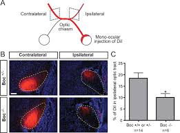 International scientific vocabulary, from latin ipse self, himself. Segregation Of Ipsilateral Retinal Ganglion Cell Axons At The Optic Chiasm Requires The Shh Receptor Boc Journal Of Neuroscience