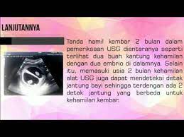 Hal ini merupakan efek smaping dari perubahan hormonal yang terjadi di tubuh bunda saat hamil muda. Tanda Tanda Hamil Kembar