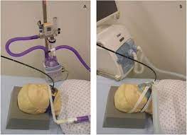 Add to my list edit this entry rate it: High Flow Nasal Cannula Oxygen Versus Non Invasive Ventilation In Patients With Acute Hypoxaemic Respiratory Failure Undergoing Flexible Bronchoscopy A Prospective Randomised Trial Critical Care Full Text