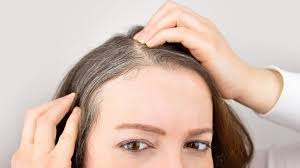 It can be exacerbated by stress, which could account for the association of white hair with terrifying experiences. Scientists Discover Why Stress Turns Hair White Bbc News