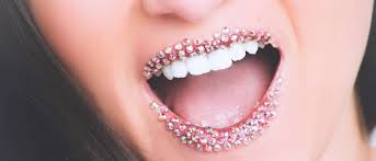 Buy 10 wings get 15!. Gusi Dan Bibir Berwarna Hitam Bisa Dibleaching Lho Guesehat